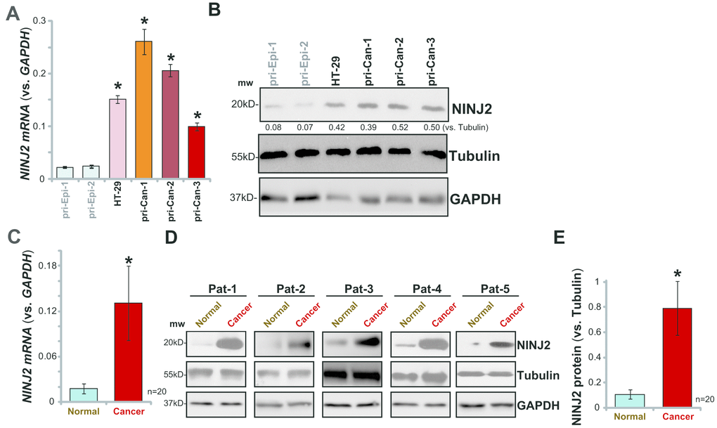 NINJ2 upregulation in human CRC cells and tissues.NINJ2 mRNA and protein levels in HT-29 cells, primary human colon cancer cells (“pri-Can-1/-2/-3”) and primary human colon epithelial cells (“pri-Epi-1/-2”) were tested by qPCR (A) and Western blotting (B and C), respectively. A total of twenty (20) pairs of human colon cancer tissues (“Cancer”) and paired surrounding normal colon epithelial tissues (“Normal”) were homogenized anddissolved in tissue lysis buffer, NINJ2 mRNA and protein expressions were tested by qPCR (C) and Western blotting (D and E), respectively. “Pat” stands for “Patient No.” (D). “mw” stands for molecular weight (same for all figures). NINJ2 mRNA was normalized to GAPDHmRNA. NINJ2 proteinwas normalized to the loading control Tubulin. Bars stand for mean ± SD (same for all Figures).* Pvs.“pri-Epi-1” cells (A and B) or “Normal” tissues (C and E).