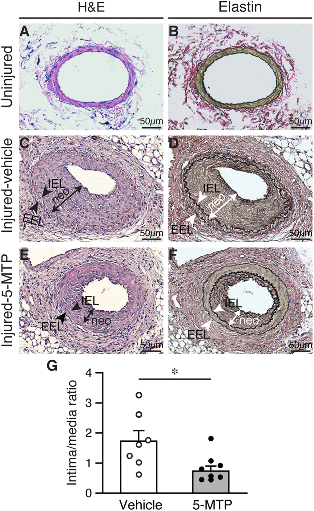 5-MTP reduces arterial denudation-induced intimal hyperplasia. Mice were subjected to femoral artery denudation injury and treated with PBS or 5-MTP. Vessels were harvested 4 weeks later. (A–B) Uninjured vessel cross sections were stained with H&E (A) or Verhoeff’s staining for elastin (B). (C–F) Sections from injured arteries from vehicle (C–D) or 5-MTP-treated (E–F) mice were stained for H&E (C and E) or elastin stain (D and F). Representative sections are shown. Arrowheads indicates internal elastic lamina (IEL) and external elastic lamina (EEL), respectively, while a line with arrowhead at both ends delineates neointima (neo). (G) Quantitative morphometric analysis of intimal and medial area and expressed as intima/media ratio in injured vehicle- (1.73±0.35, n=7) and 5-MTP-treated (0.73±0.17, n=9) mice (*p=0.0076 vs. vehicle).
