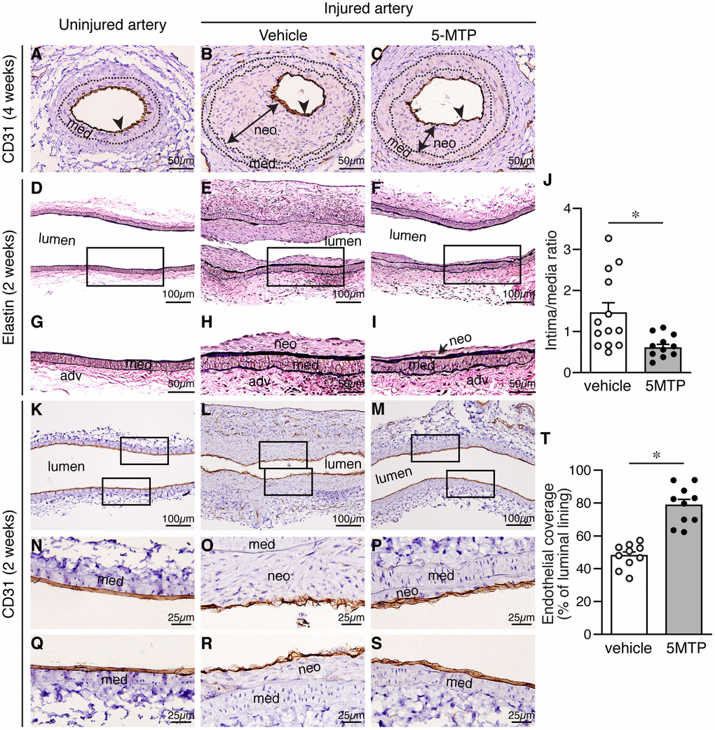 5-MTP increases endothelial coverage following arterial denudation. Arteries from uninjured and injured mice were harvested and sectioned for histological analysis. (A–C) Four weeks after injury, arterial sections from uninjured (A) and injured-vehicle (B) or injured-5-MTP (C) mice were stained with CD31 antibody to delineate endothelium (brown, arrowhead). A line with arrowheads at both ends indicates neointima (neo). med, media. (D–F) Two weeks after injury, longitudinal arterial sections from uninjured (D), injured vehicle-treated (E), and injured 5-MTP-treated (F) mice were stained with Verhoeff’s elastin stain. (G–I) Magnified areas from boxed area in (D–F), respectively. (J) Quantitative morphometric analysis of intima/media ratio in vehicle (1.45±0.24, n=13) and 5-MTP-treated (0.60±0.09, n=12) mice (*p=0.0056 vs. vehicle). (K–M) CD31 immunohistochemistry to identify endothelial cells (brown). Artery from uninjured (K), Injured vehicle-treated (L), and injured 5-MTP-treated (M) mice. (N–P) Magnified areas from upper box of (K–M), respectively. (Q–S) Magnified areas from lower box of (K–M), respectively. (T) Quantitation of endothelial coverage in vehicle (47.9±2.3%, n=10) and 5-MTP-treated mice (78.6±3.7%, n=10; *p=0.000001).