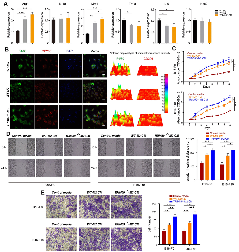TRIM59-/--M2 macrophage CM promotes melanoma cell migration and invasion. (A) The expression of Arg1, IL-10, Mrc1, TNF-α, IL-6, and NOS2 was detected by qRT-PCR. Data are represented as mean ± SD. *pppp-/--M2 vs. WT-M2. (B) Immunofluorescent detection of F4/80 and CD206. Fluorescence intensity was analyzed by a 3D surface plot using ImageJ. Scale bars = 100 μm. (C) Proliferation assay results from B16-F0 and B16-F10 cells treated with control media, WT-M2 CM, or TRIM59-/--M2 CM. Data are represented as mean ± SD. *ppp-/--M2 CM. (D) Representative images from wound healing (cell migration) assays and data quantification. Data are represented as mean ± SD. **ppp-/--M2 CM vs. WT-M2 CM. (E) Representative images from transwell (cell invasion) assays and data quantification. Data are represented as mean ± SD. **pppp-/--M2 CM vs. WT-M2 CM.