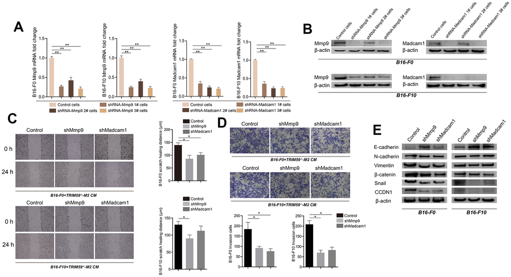 Knockdown of MMP-9 or Madcam1 inhibits migration, invasion, and EMT in melanoma cells. (A) Expression of MMP-9 and Madcam1 in B16-F0 and B16-F10 cells transfected with MMP-9-shRNA, Madcam1-shRNA or scrambled (control)-shRNA, as assessed by qRT-PCR. Data are represented as mean ± SD. **pB) Expression of MMP9 and Madcam1 in B16-F0 and B16-F10 cells transfected with MMP-9-shRNA, Madcam1-shRNA, or scrambled (control)-shRNA, as assessed by western blotting. A representative image from three independent experiments is shown. (C) Representative images of cell migration assays conducted on B16-F10 cells transfected with control shRNA, MMP-9-shRNA, or Madcam1-shRNA. Data are represented as mean ± SD. *pD) Representative images of transwell invasion assays conducted on B16-F10 cells transfected with control shRNA, MMP-9-shRNA, or Madcam1-shRNA. Data are represented as mean ± SD. *pE) Western blot detection of EMT-associated proteins, including E-cadherin, N-cadherin, and vimentin, in B16-F0 and B16-F10 cells after shRNA-mediated downregulation of MMP-9 or Madcam1.