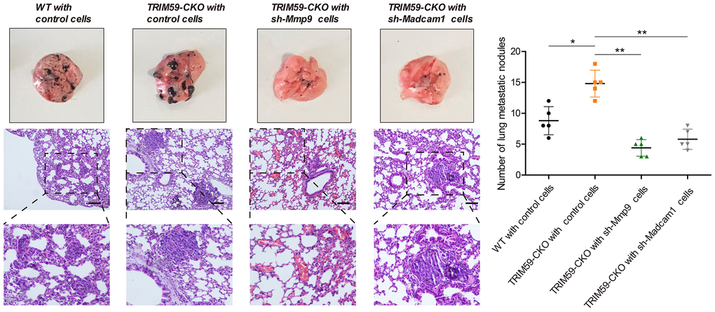 MMP-9 or Madcam1 silencing decreases pulmonary metastasis of melanoma cells. Representative macroscopic and H&E images of mouse lungs colonized by metastatic B16-F10 melanoma cells. Scale bar = 20 μm. Quantification of metastatic foci (mean ± SD, n = 5) for each experimental condition is shown. Data are represented as mean ± SD. *pp