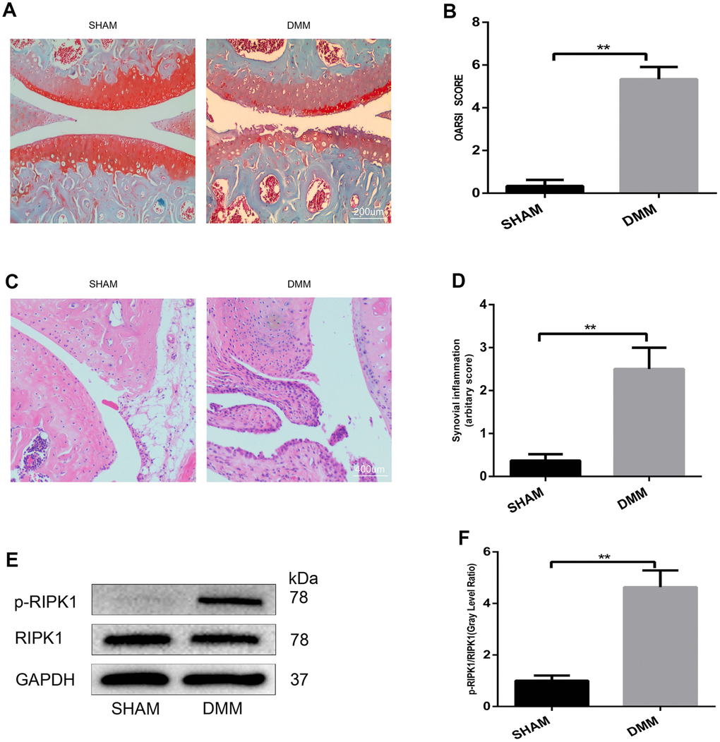 The phosphorylation level of RIPK1 is increased in mouse knee articular cartilage. (A, B) Safranin O/Fast Green-stained sagittal-plane images of tibial and femoral cartilage from the sham and destabilized medial meniscus (DMM) groups; the Osteoarthritis Research Society International (OARSI) score was significantly increased in the DMM group (n = 10); scale bar = 200 μm. (C, D) Representative hematoxylin and eosin (HE)-stained images and synovial inflammation scores in the sham and DMM groups (n = 10); scale bar = 400 μm. (E, F) Western blots and quantitative data of p-RIPK1 in the sham and DMM groups. The experiments were repeated three times independently. Columns represent means ± SD. **p 