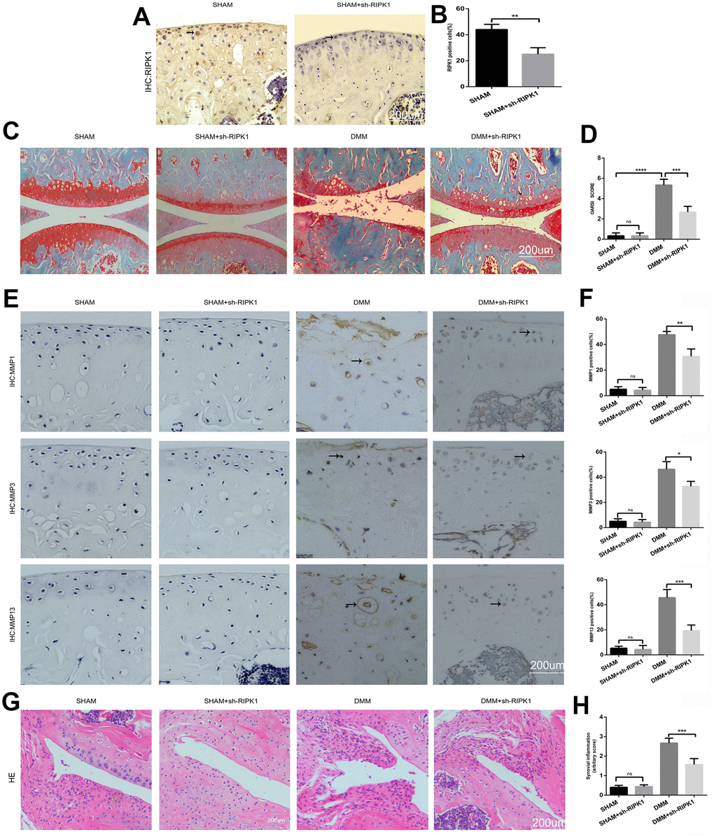 Knockdown of receptor interacting serine/threonine kinase (RIPK) 1 attenuates cartilage degeneration in vivo. (A, B) Immunohistochemical staining of RIPK1 in mice transfected with Ad-NC and Ad-shRIPK1 (n = 10); scale bar = 200 μm. (C, D) Safranin O/Fast Green-stained articular cartilage; the degree of cartilage degeneration was evaluated by calculating the OARSI score (n = 10); scale bar = 200 μm. (E, F) Immunohistochemical staining of matrix metalloproteinases (MMPs; n = 10); scale bar = 200 μm. (G, H) Representative HE-stained images and synovial inflammation scores (n = 10); scale bar = 200 μm. Columns represent means ± SD. *p 