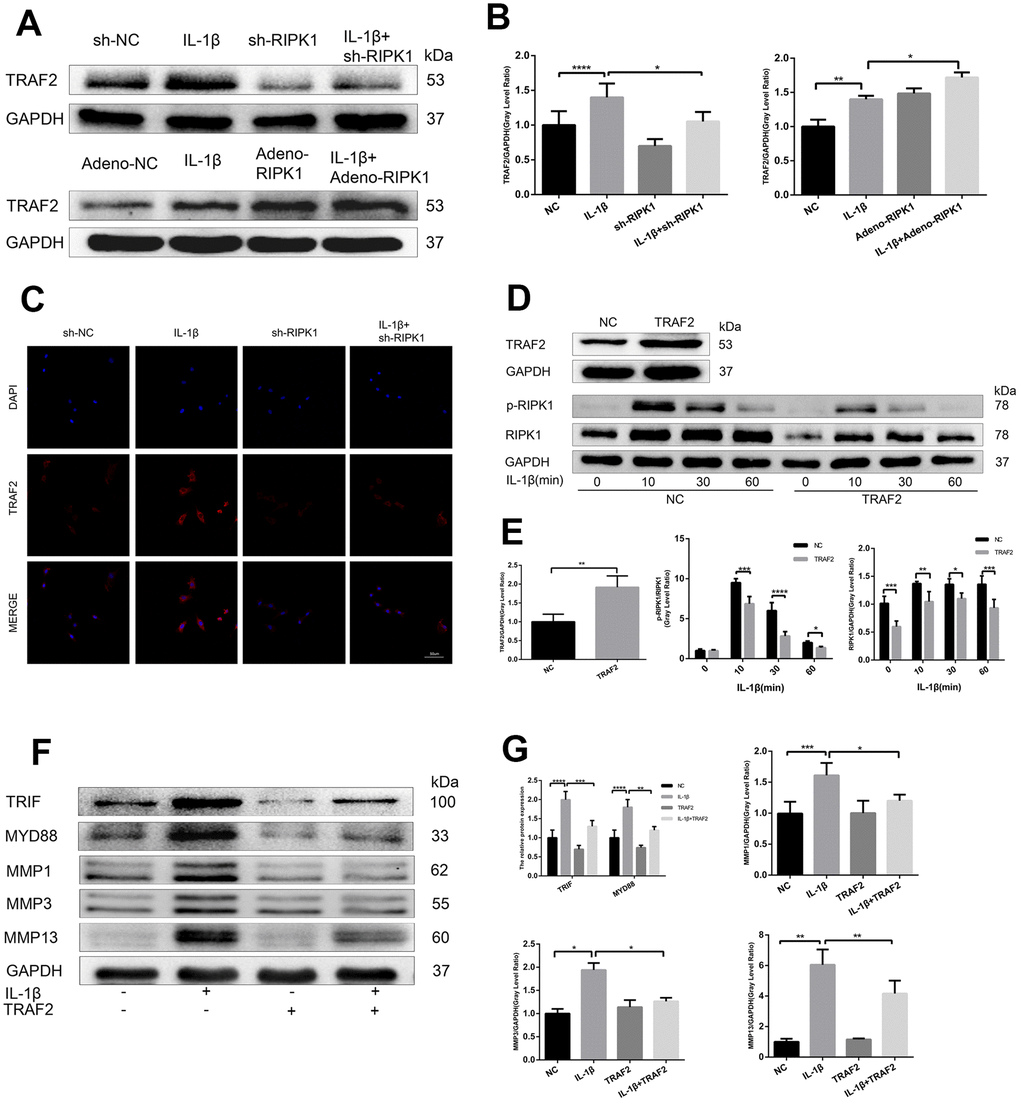 TRAF2 regulates RIPK1-mediated inflammation. (A, B) Western blots and quantitative data of TRAF2 in chondrocytes transfected with Ad-shRIPK and Ad-RIPK1 in the presence and absence of IL-1β. © TRAF2 expression determined by immunofluorescence staining. Scale bar = 50 μm. (D, E) Western blots and quantitative data of p-RIPK1 and RIPK1. (F, G) Western blots and quantitative data of TRIF, MYD88, and MMPs. The experiments were repeated three times independently. Columns represent means ± SD. *p 