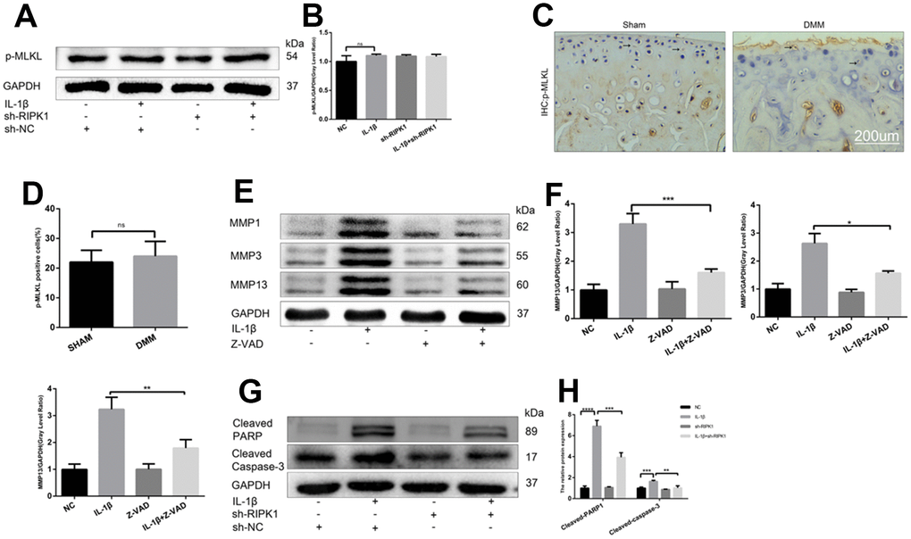 RIPK1 kinase-mediated osteoarthritis is dependent on apoptosis but not mixed lineage kinase domain-like pseudokinase (MLKL)-dependent necroptosis. (A, B) Western blots and quantitative data of p-MLKL. (C, D) Immunohistochemical staining of p-MLKL in the normal and DMM groups (n = 10); scale bar = 200 μm. (E, F) Western blots and quantitative data of MMPs. (G, H) Cleaved caspase 3 and cleaved poly (ADP-ribose) polymerase (PARP) levels in mouse chondrocytes treated as above. The experiments were repeated three times independently. *p 