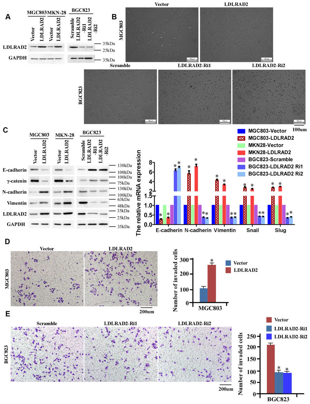 LDLRAD2 promotes in vitro migration and invasion of GC cells. Overexpression of LDLRAD2 in MGC-803 and MKN28 cell lines and silenced LDLRAD2 in BGC823 cell line (A). Overexpression of LDLRAD2 significantly enhanced morphological characteristics of EMT of MGC-803 cell line, while silence of LDLRAD2 significantly inhibited morphological characteristics of EMT of BGC823 cell line (B). Western blotting analysis showed that the expression levels of epithelial cell markers such as E-cadherin and γ-catenin were dramatically decreased, while mesenchymal cell markers such as N-cadherin and vimentin were significantly increased in LDLRAD2-overexpression cell lines (C). The expression levels of epithelial cell markers were increased, while mesenchymal cell markers were decreased in LDLRAD2-silenced cell line, (C). LDLRAD2-overexpression MGC-803 cell exhibited significantly enhanced invasive capability (D), while LDLRAD2-silenced BGC-823 cell had dramatically decreased invasive capability (E).