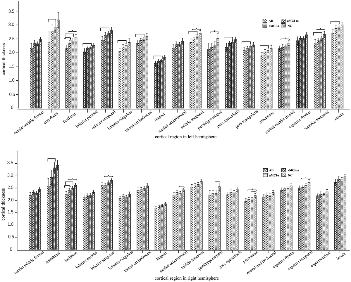 Amnestic Mild Cognitive Impairment Multiple Domain