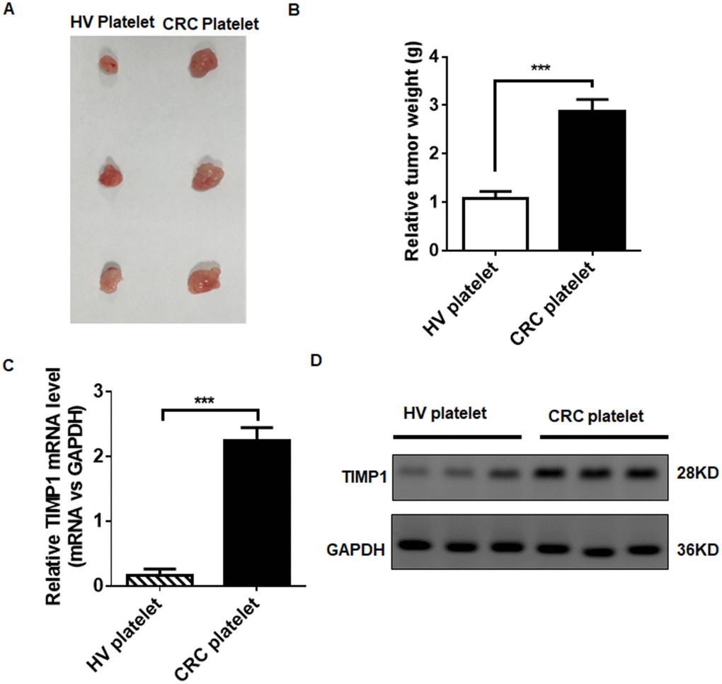 TEPs promote CRC growth. (A–B) HT29 tumor-bearing mice were excised at 24 days, imaged macroscopically, and weighed. (C–D) The mRNA © and protein (D) levels in tumors injected with platelets from CRC patients and HVs. **P P 