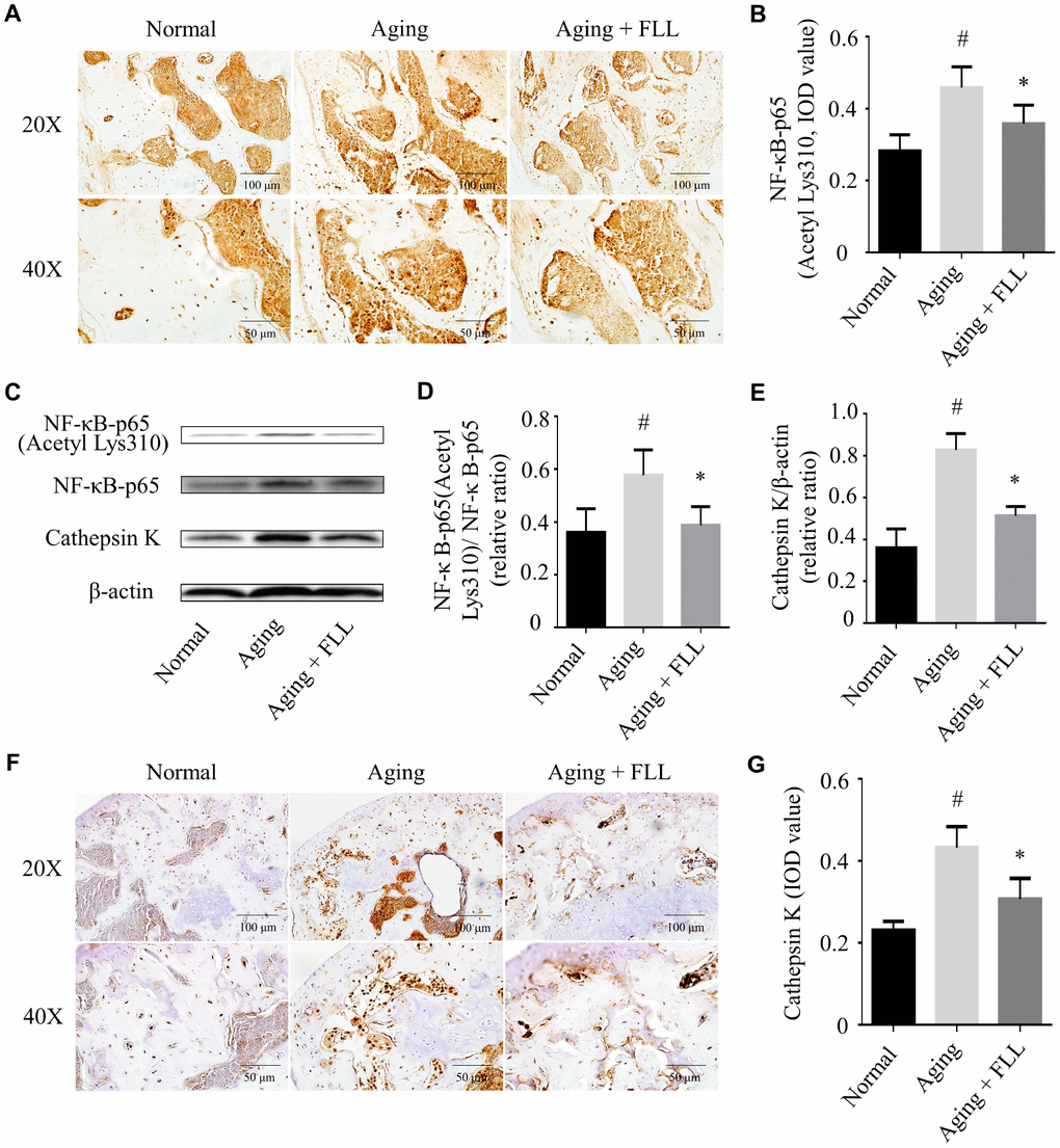 Fructus Ligustri Lucidi (FLL) inhibits NF-κB activation and CatK expression in the tibias and femurs of aging mice. The representative images of immunohistochemical staining (original magnification, ×200, ×400) and western blot, and their analyses showed the acetylation of NF-κB-p65 (A–B), relative expression of NF-κB-p65 acetylation to NF-κB-p65 (C–D) and CatK (C, E–G) in the femurs and tibias. Data are presented as mean ± SD. # compared with the normal group. * compared with the aging model group. p 