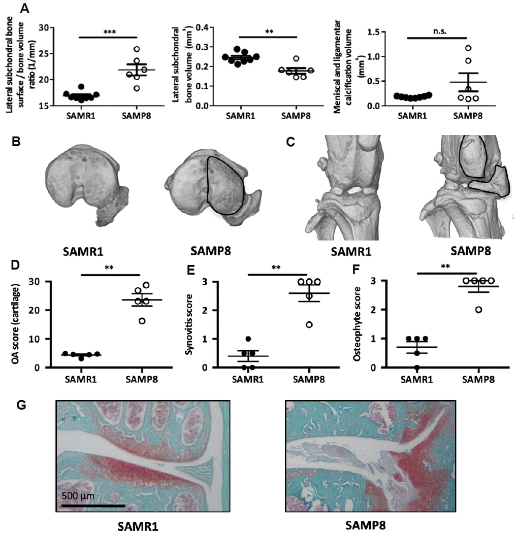 SAMP8 mice display a spontaneous OA phenotype. (A) Histo-morphometric analysis by micro-CT of the left knee in SAMR1 and SAMP8 mice. Graphs represent the mean ± SEM (n=8 for SAMR1, n=5 for SAMP8); **=pB) Representative micro-CT images showing higher sub-chondral bone modification and (C) ligament calcifications in SAMP8 mice compared with SAMR1 mice. Knees from SAMR1 and SAMP8 mice were stained with Safranin-O/Fast Green to quantify: (D) spontaneous cartilage degradation (OA modified score according to van den Berg, from 0 to 30), (E) spontaneous synovial membrane inflammation (synovitis semi-quantitative score, from 0 to 3), and (F) osteophytes (osteophyte semi-quantitative score, from 0 to 3). Data are the mean ± SEM (n=5 for each condition). **=pG) Representative images of the spontaneous OA phenotype in SAMP8 mice with cartilage degradation compared with SAMR1 mice.