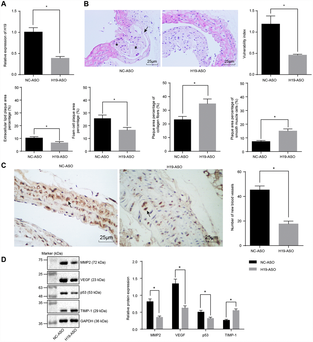 Atherosclerotic vulnerable plaque formation and intraplaque angiogenesis of ApoE knockout mice with AS are inhibited by H19 silencing. (A) The silencing efficiency of H19 assessed by RT-qPCR. * p vs. the NC-ASO group. (B) The atherosclerotic vulnerable plaque formation evaluated by HE staining (× 400) (The arrow referred to lipid vacuoles, * represented inflammatory cells and # indicated fractured smooth muscle.). (C) The number of new blood vessels measured by Immunohistochemical staining (× 400) (The arrow referred to CD34-positive cells). (D) The protein levels of MMP-2, VEGF, p53 and TIMP-1 in atherosclerotic plaques normalized to GAPDH after H19 silencing determined by Western blot analysis. * p vs. the NC-ASO group. The data were measurement data and expressed by mean ± standard deviation. Data differences between two groups were analyzed by unpaired t-test. n = 6. The experiment was repeated three times independently.