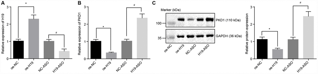 The level of PKD1 is elevated by silencing of H19. (A) The silencing or overexpressing efficiency of H19 assessed by RT-qPCR. (B) The transcriptional level of PKD1 after silencing or overexpressing H19 in atherosclerotic tissues determined by RT-qPCR. (C) The protein level of PKD1 after silencing or overexpressing H19 in atherosclerotic tissues normalized to GAPDH evaluated by Western blot analysis (the unprocessed blots are shown in Supplementary Figure 1). * p vs. the oe-NC group; # p vs. the NC-ASO group. The data were measurement data and expressed by mean ± standard deviation. Data differences between two groups were analyzed by unpaired t-test. n = 6. The experiment was repeated three times independently.
