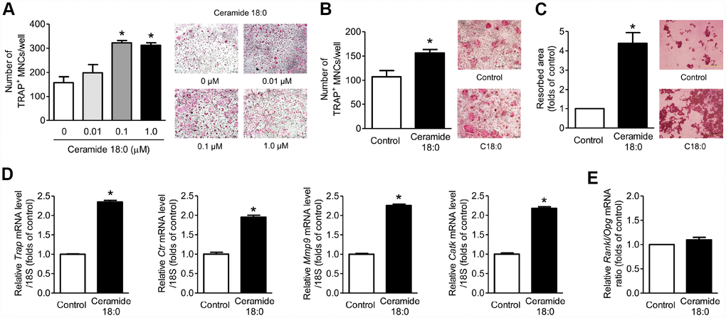 Ceramide 18:0 stimulates osteoclast differentiation. (A) Primary mouse BMMs were incubated with 30 ng/mL M-CSF and 100 ng/mL RANKL in the absence or presence of the indicated concentration of C18:0 for four days. After staining cells with TRAP, the number of TRAP-positive multinucleated cells (MNCs) (≥3 nuclei/cell) was determined to assess osteoclast differentiation. (B) Mouse BMMs were cocultured with primary calvaria osteoblasts for 10 days in medium containing 10−8 M 1α,25-OH(2) D3 and 10−6 M prostaglandin E2 without or with 0.1 μM C18:0. (C) Mouse BMMs were cultured with 30 ng/mL M-CSF and 100 ng/mL RANKL on dentine discs in the absence or presence of 0.1 μM C18:0 for 10 days. Resorption pits were visualized by staining with hematoxylin. (D) qRT-PCR expression analysis of osteoclast differentiation markers in mouse BMMs exposed to 30 ng/mL M-CSF and 100 ng/mL RANKL in the absence or presence of 0.1 μM C18:0 for 4 days. (E) qRT-PCR analysis to determine relative Rankl and Opg expression in mouse calvaria osteoblasts exposed to 50 μg/mL ascorbic acid and 10 mM β-glycerophosphate in the absence or presence of 0.1 μM C18:0 for 7 days. Scale bars: 500 μm for (A–C). Data are presented as mean ± SEM. *P U test or ANOVA followed by Tukey’s posthoc analysis.