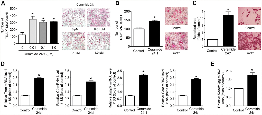 Ceramide 24:1 stimulates osteoclast differentiation. (A) Primary mouse BMMs were incubated with 30 ng/mL M-CSF and 100 ng/mL RANKL in the absence or presence of the indicated concentration of C24:1 for 4 days. After staining cells with TRAP, the number of TRAP-positive MNCs (≥ 3 nuclei/cell) was determined to assess osteoclast differentiation. (B) Mouse BMMs were cocultured with primary calvaria osteoblasts for ten days in a medium containing 10−8 M 1α,25-OH(2) D3 and 10−6 M prostaglandin E2 without or with 0.01 μM C24:1. (C) Mouse BMMs were cultured with 30 ng/mL M-CSF and 100 ng/mL RANKL on dentine discs in the absence or presence of 0.01 μM C24:1 for ten days. Resorption pits were visualized by staining with hematoxylin. (D) qRT-PCR expression analysis of osteoclast differentiation markers in mouse BMMs exposed to 30 ng/mL M-CSF and 100 ng/mL RANKL in the absence or presence of 0.01 μM C24:1 for 4 days. (E) qRT-PCR analysis to determine relative Rankl and Opg expression in mouse calvaria osteoblasts exposed to 50 μg/mL ascorbic acid and 10 mM β-glycerophosphate in the absence or presence of 0.01 μM C24:1 for seven days. Scale bars: 500 μm for (A–C). Data are presented as mean ± SEM. *P U test or ANOVA followed by Tukey’s posthoc analysis.