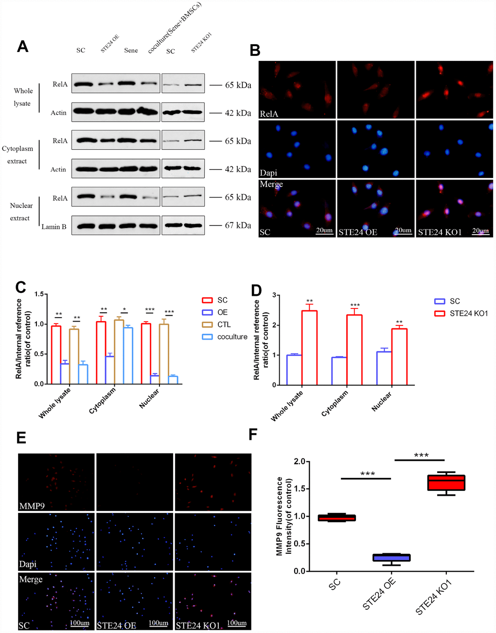 Correlation between ZMPSTE24 and TNF-α induced RelA activation. (A, C, D) Protein expression of RelA with stable empty vector (SC), ZMPSTE24 overexpression or knockout of ZMPSTE24 were visualized by western blot and quantified by Image J. n=3. (B) The nuclear translocation of RelA was detected by immunofluorescence combined with DAPI staining for nuclei. n=5. Scale bar: 20 μm. (E–F) Immunofluorescence staining of MMP9 combined with DAPI staining for nuclei. n=5, Scale bar, 50um. Values represent means±S.D. Significant differences between different groups are indicated as *P 