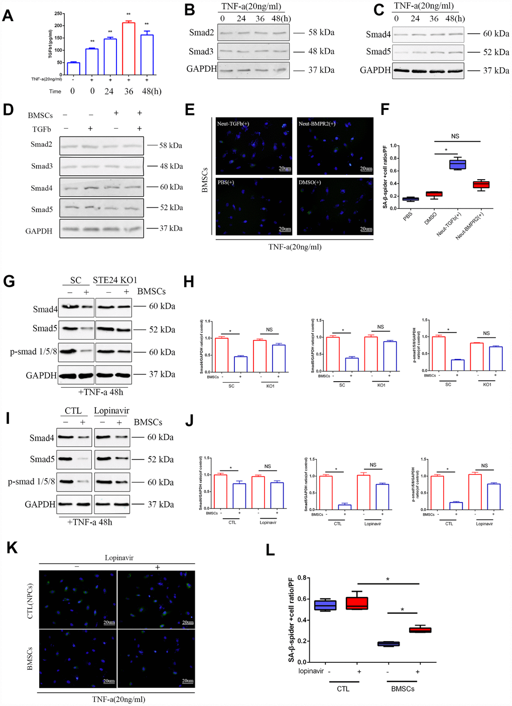 Effects of ZMPSTE24 on senescence associated TGFβ/Smad signaling pathway. (A) Elisa result of TGFβ1 in senescent NPCs culture supernatant. (B–C) Protein expressions of Smad2, Smad3, Smad4 and Smad5 under TNF-a inducing were visualized by western blot and quantified by Image J. n=3. (D) Protein expression of Smad2, Smad3, Smad4 and Smad5 were visualized by western blot and quantified by Image J. n=3. (E–F) Spider-β-gal staining of NP cells between different neutralizing groups(Neut-TGFb and Neut-BMPR2). Combined with DAPI staining for nuclei. n=5, Scale bar, 20um. (G–H) Protein expression of Smad4, Smad5 and p-Smad1/5/8 in NP cells with stable scramble vector (SC) or knockout of ZMPSTE24 were visualized by western blot and quantified by Image J. n=3. (I–J) Protein expression of Smad4, Smad5 and p-Smad1/5/8 in NP cells with or without BMSCs coculture were visualized by western blot and quantified by Image J. n=3. (K–L) Spider-β-gal staining of NP cells between different coculture groups(NPCs or BMSCs) with or without lopinavir. Combined with DAPI staining for nuclei. n=5, Scale bar, 20um. Values represent means±S.D. Significant difference between different groups is indicated as *P 