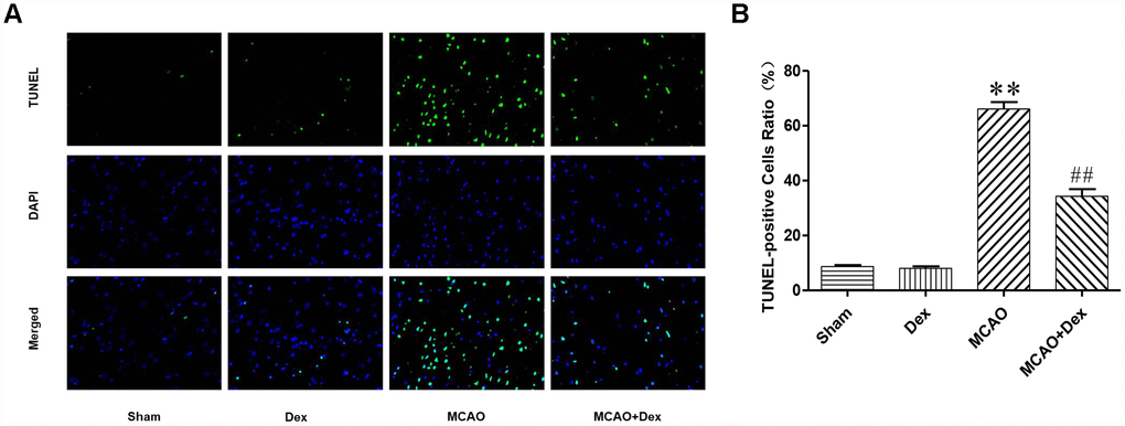Dexmedetomidine attenuated the neuronal apoptosis induced by CIRI. (A) TUNEL staining was performed on slices from the cerebral ischemic penumbra. a. Sham operation (Sham) group, b. dexmedetomidine administration (Dex) group, c. MCAO model control (MCAO) group, d. MCAO + dexmedetomidine administration (MCAO + Dex) group. (B) Ratio of positive cells. Magnification is 400x. n = 6. Data are expressed as the mean ± SEM. *P #P ##P 