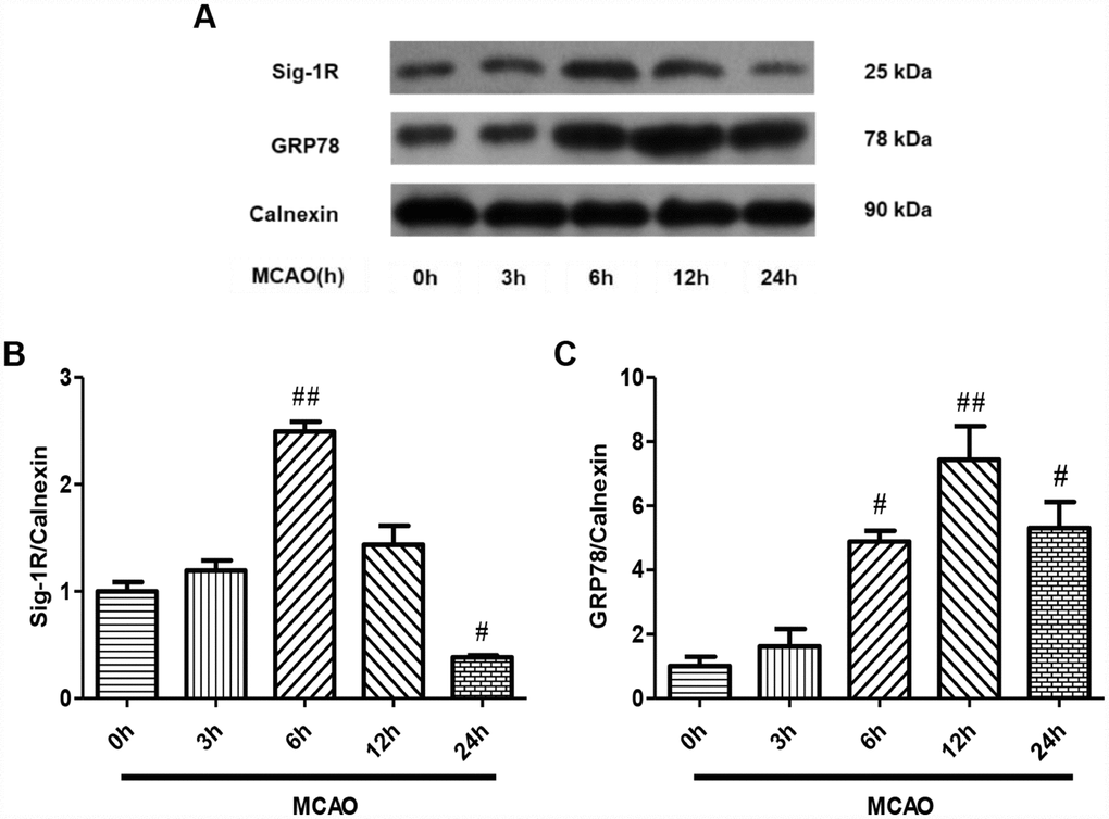 Sig-1R and GRP78 protein expression on the ER after CIRI. (A) The protein levels of Sig-1R and GRP78 were determined by Western blotting. (B) Sig-1R protein levels with increasing reperfusion times. (C) GRP78 protein levels with increasing reperfusion times. The results were normalized to the percentage of Calnexin expression. Data are shown as the mean ± SEM, n = 6 per group. #P ##P 