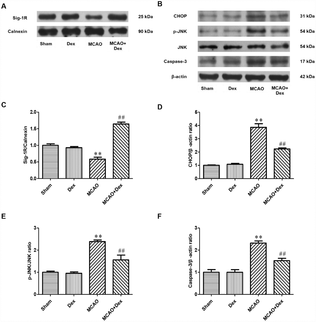The effects of dexmedetomidine on the expression of Sig-1R and ERS-induced apoptotic proteins after CIRI. (A) The protein levels of Sig-1R in the cerebral ischemic penumbra were determined by Western blotting. (B) The levels of ERS-induced apoptotic proteins (CHOP, p-JNK/JNK, Caspase-3) in the cerebral ischemic penumbra were determined by Western blotting. (C) Sig-1R protein expression. (D) CHOP protein expression. (E) p-JNK/JNK protein expression. (F) Caspase-3 protein expression. The results were normalized to the percentage of Calnexin or β-actin expression. Data are shown as the mean ± SEM, n = 6 per group. *P #P ##P 
