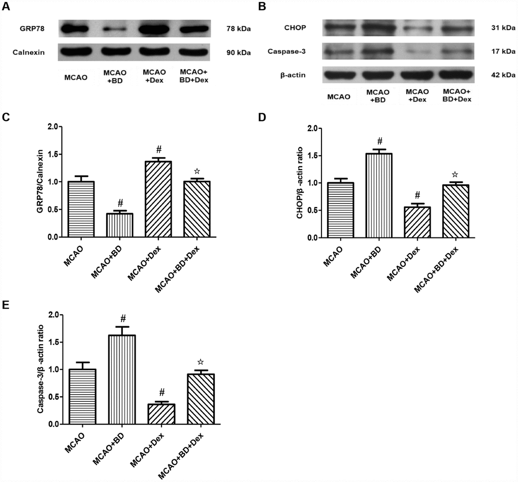The effects of dexmedetomidine on the ERS signaling pathway involving Sig-1R after CIRI. (A) GRP78 protein levels on the ER were determined by Western blotting. (B) The ERS-induced apoptotic proteins (CHOP, Caspase-3) from the cerebral ischemic penumbra were determined by Western blotting. (C) GRP78 protein levels. (D) CHOP protein levels. (E) Caspase-3 protein levels. The results were normalized to the percentage of Calnexin or β-actin expression. Data are shown as the mean ± SEM, n = 6 per group. #P ##P ☆P ☆☆P 