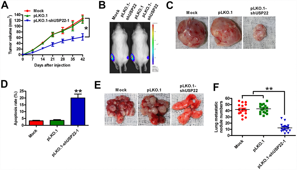USP22 depletion reduces in vivo GC growth and metastasis. Six-week-old male SCID mice were subcutaneously injected with stably-expressed pLKO.1-shUSP22-1 or pLKO.1 BGC-823-luc cells into the hind flanks or through the tail vein. (A) Histogram shows tumor volume at weeks 1, 2, 3 and 4 after subcutaneous injection of SCID mice (n=5 each) with BGC-823-luc cells stably-expressing pLKO.1-shUSP22-1 or pLKO.1 BGC-823-luc cells into the hind flanks at 1, 2, 3 and 4 weeks. (B) Analysis of tumor growth progression by in vivo luciferase imaging of the xenografts at day 21 after subcutaneous injection of SCID mice (n=5 each) with stably-expressed pLKO.1-shUSP22-1 or pLKO.1 BGC-823-luc cells. (C) Representative photographs of xenograft tumors at day 42 from SCID mice subcutaneously injected with stably-expressed pLKO.1-shUSP22-1 or pLKO.1 BGC-823-luc cells. (D) TUNEL assay results show the total number of apoptotic cells in the xenograft tumor sections derived at day 42 from from SCID mice subcutaneously injected with stably-expressed pLKO.1-shUSP22-1 or pLKO.1 BGC-823-luc cells. (E) Representative images and (F) Total number of s metastatic nodules in the lungs at day 28 from SCID mice that were injected with stably-expressed pLKO.1-shUSP22-1 or pLKO.1 BGC-823-luc cells. Note: Data are expressed as mean ± SD of three replicates; *p p 