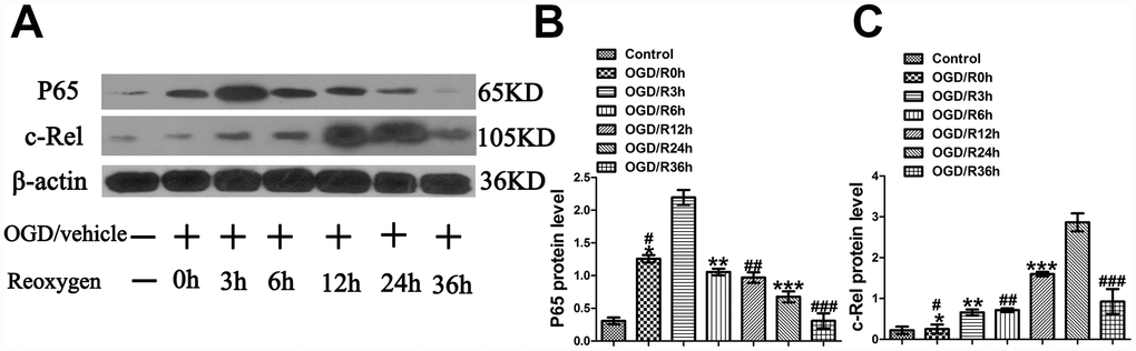 OGD-induced peaks of p65 and c-Rel at different time points in cultured primary cortical neurons after OGD injury. (A) The representative image of western blot analysis for p65 and c-Rel. (B) Western blot analysis of p65 (n=3). *p#pp##pp###ppC) Western blot analysis of c-Rel (n=3). *p>0.05, as compared with Control group; #pp##pp###pp