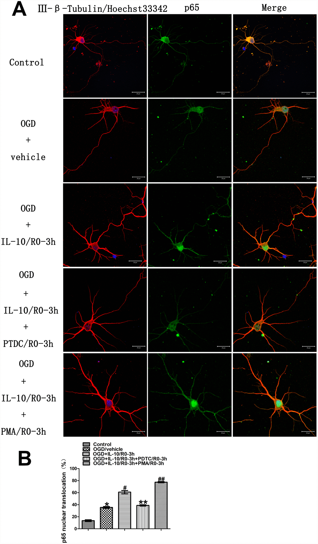 Localization and nuclear translocation of p65 at an early stage after OGD injury. (A) Representative images of each group. The left column displays neuronal marker class Ⅲ-β-Tubulin (red) and nucleus (blue). The middle column shows expression of p65 (green). The right column indicates the co-localization of class Ⅲ-β-Tubulin, nucleus and P65. Scale bar is 20 μm. (B) Quantification of p65 nuclear translocation. *p#pp##pp