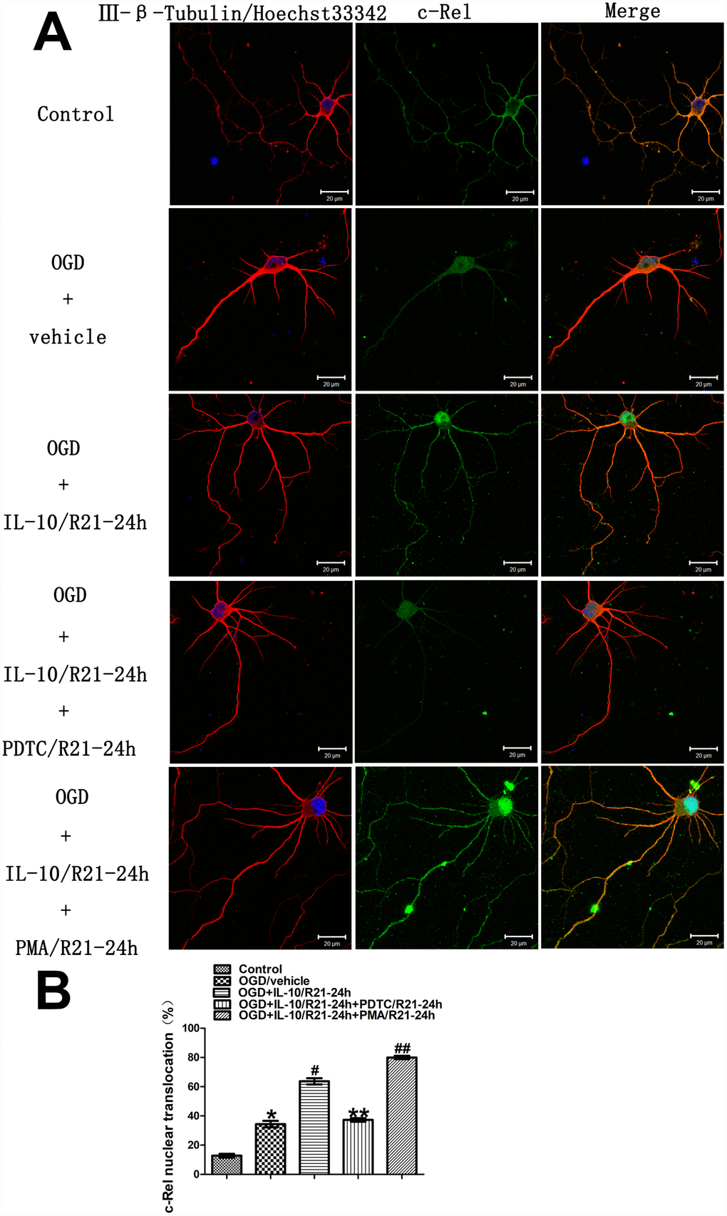 Localization and nuclear translocation of c-Rel at a late stage after OGD injury. (A) Representative images of each group. The left column displays neuronal marker class Ⅲ-β-Tubulin (red) and nucleus (blue). The middle column shows expression of c-Rel (green). The right column indicates the co-localization of class Ⅲ-β-Tubulin, nucleus and c-Rel. Scale bar is 20 μm. (B) Quantification of c-Rel nuclear translocation. *p#pp##pp