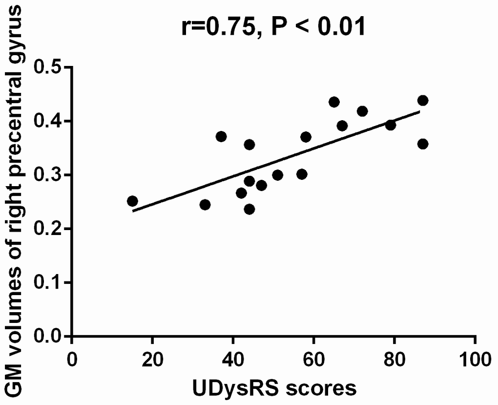 Correlation between the mean GM volumes of the cluster showing difference and UDysRS scores in early-onset PD patients with diphasic dyskinesia. The mean GM volumes of right precentral gyrus was positively correlated with UDysRS scores (r=0.75, P 
