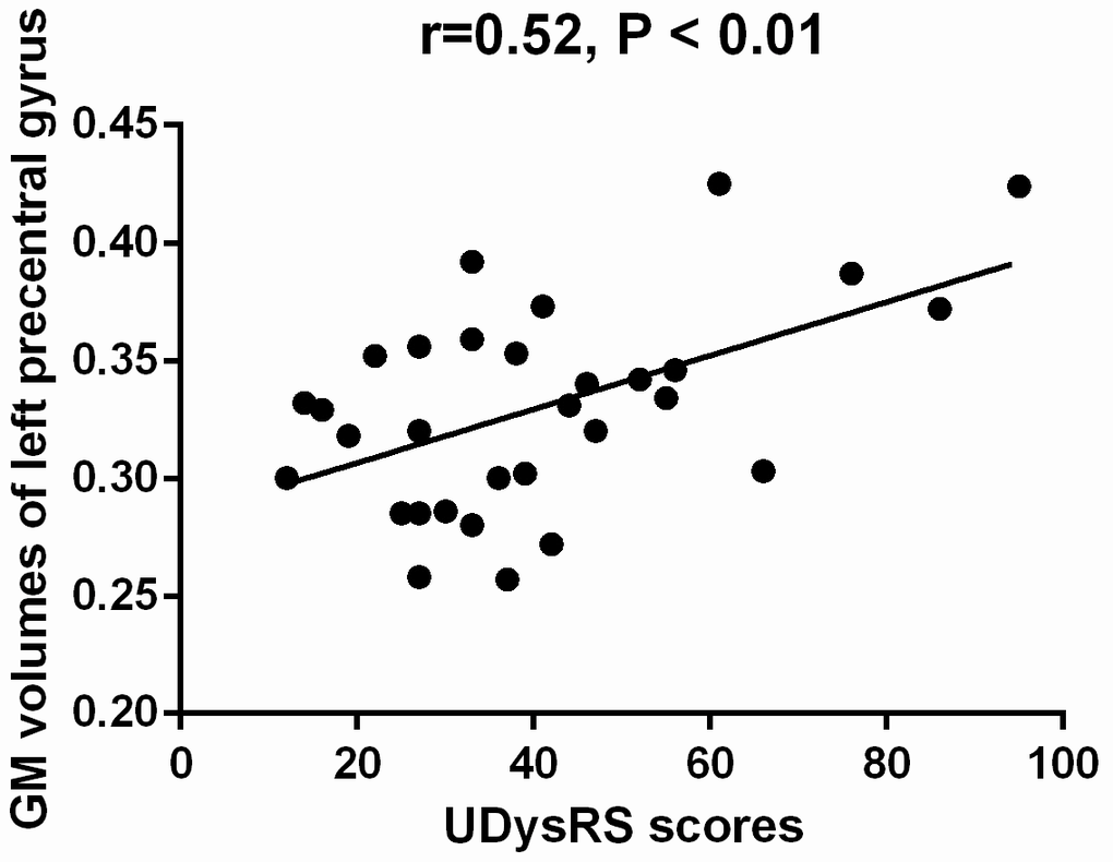 Correlation between the mean GM volumes of the cluster showing difference and UDysRS scores in late-onset PD patients with diphasic dyskinesia. The mean GM volumes of left precentral gyrus was positively correlated with UDysRS scores (r=0.52, P 
