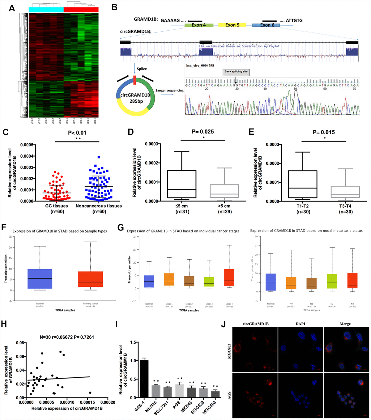 Circular Rna Circgramd1b Inhibits Gastric Cancer Progression By