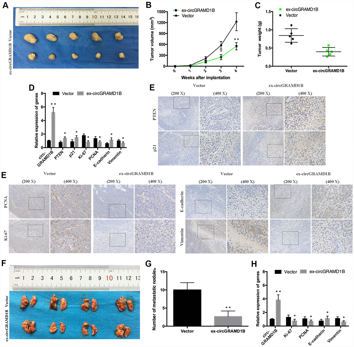 Circular Rna Circgramd1b Inhibits Gastric Cancer Progression By