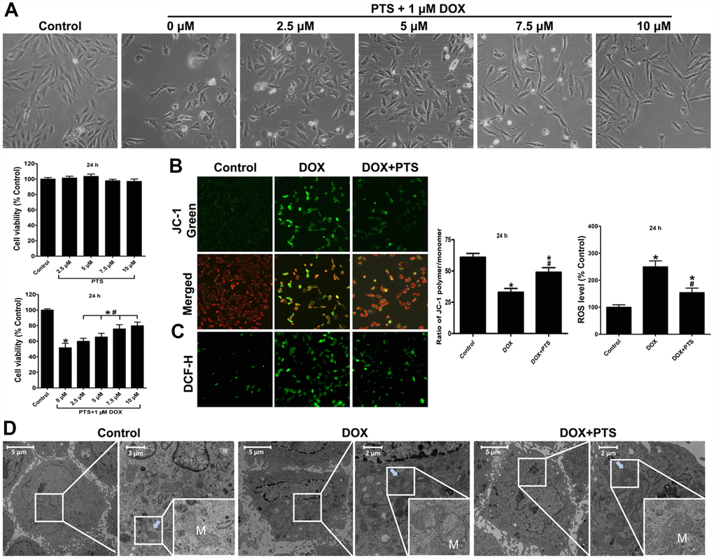 Effect of pterostilbene treatment on cell viability, mitochondrial membrane potential, ROS generation, mitochondrial morphologic changes in DOX-treated H9c2 cells (24 h). (A) single pterostilbene (2.5-10 μM) treatment and cotreatment of 1 μM DOX with increasing concentrations of pterostilbene (2.5-10 μM) on H9c2 cell viability (24 h). (B) mitochondrial membrane potential (ΔΨm) was expressed as the ratio of JC-1 polymer/monomer; red fluorescence represents the mitochondrial JC-1 polymer, and green fluorescence represents the monomeric form of JC-1, indicating ΔΨm depolarization. (C) Representative images and ROS level, and the indexes in the control group are defined as 100%. (D) Representative images of the ultrastructural morphology of mitochondria in each group of H9c2 cells are shown. The results are expressed as the mean ± SEM. *P #P 