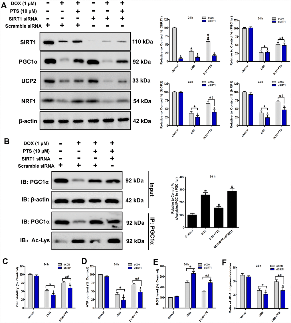 Effect of pterostilbene treatment combined with SIRT1 siRNA on cell viability, ATP content, ROS generation and ΔΨm, and SIRT1 and PGC1α signaling in DOX-treated H9c2 cells (24 h). (A) and (B) Representative western blot results of SIRT1, PGC1α, Ac-PGC1α, UCP2 and NRF1 are shown. Membranes were re-probed for β-actin expression to show that similar amounts of protein were loaded in each lane. IB, immunoblot; IP, immunoprecipitation. (C) Cell viability, (D) cellular ATP content, (E) ROS level and (F) ΔΨm are shown, and (C–E) three indexes in the Control group of siCON are defined as 100%. The results are expressed as the mean ± SEM. *P #P $P 