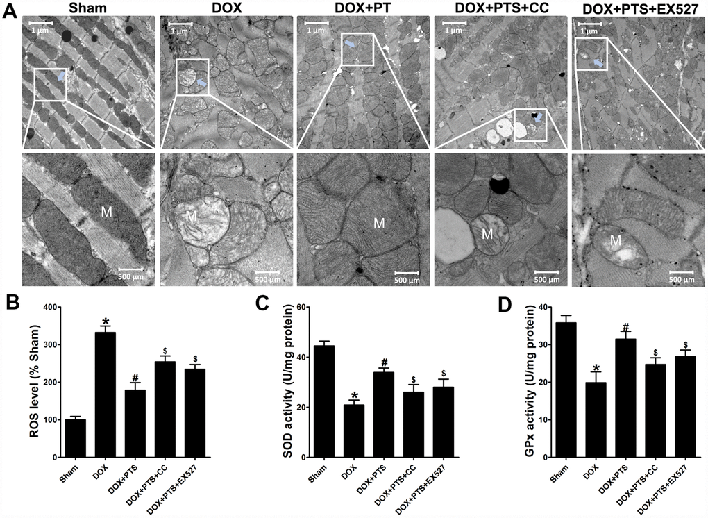 Effect of pterostilbene treatment combined with Compound C or EX527 on cardiac toxicity and oxidative stress in DOX-exposure mice hearts. (A) Representative images of the ultrastructural morphology of mitochondria from the left ventricular myocardium of experimental mice (magnification: upper panel 9900 ×, lower panel 20,500 ×). (B) ROS level, (C) SOD and (D) GPx activity in the myocardial tissues are showed. The results are expressed as the mean ± SEM. *P #P $P 
