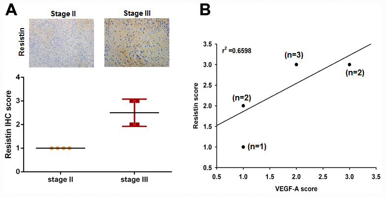 Clinical significance of resistin expression in tissue specimens from patients with osteosarcoma. (A) Tumor specimens were subjected to immunohistochemistry (IHC) evaluations with anti-resistin monoclonal antibody and the staining intensity was graded as 0 (no positive cell staining), 1 (1–24%, weakly positive), 2 (25–49%, moderately positive), or 3 (50–100%, strongly positive). (B) Positive correlations were observed between levels of resistin and VEGF-A expression.