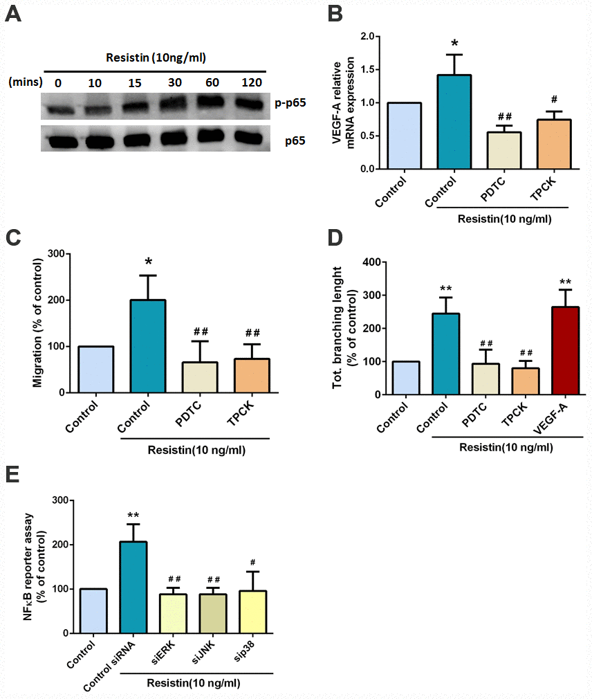 Resistin promotes VEGF-A expression in osteosarcoma and contributes to angiogenesis through the NF-κB signaling pathway. (A) Osteosarcoma 143B cells were incubated with resistin (10 ng/ml) for the indicated times and p65 phosphorylation was determined by Western blot analysis. (B) Osteosarcoma 143B cells were pretreated with NF-κB inhibitors (PDTC 10 μM; TPCK 3 μM) for 30 min then stimulated with resistin (10 ng/ml) for 24 h. VEGF-A expression was examined by qPCR. (C–D) Osteosarcoma 143B cells were pretreated with NF-κB inhibitors (PDTC 10 μM; TPCK 3 μM) for 30 min then stimulated with resistin (10 ng/ml) for 24 h. CM was collected and applied to EPCs for 24 h. Cell migration and capillary-like structure formation in EPCs were examined by Transwell and tube formation assays, respectively. (E) Cells were transfected with indicated siRNA, the luciferase activity was examined. The results were obtained from three independent experiments. * p p p #p ##p 