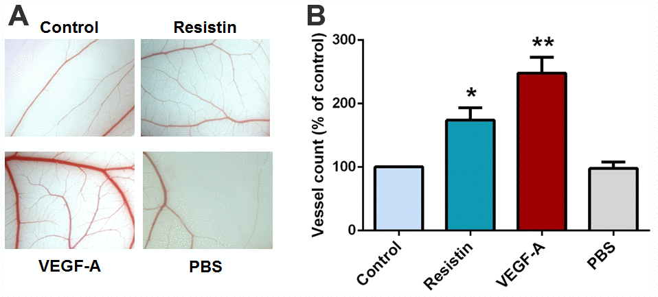Effects of resistin on VEGF-A-induced angiogenesis in the CAM model. (A) PBS, VEGF-A (50 ng/ml), control osteosarcoma 143B cell CM and resistin-treated osteosarcoma 143B CM were mixed in Matrigel and subjected to the CAM assay, then photographed with a stereomicroscope on developmental day 12. (B) Angiogenesis was quantified by counting the number of blood vessel branches. * p p p 