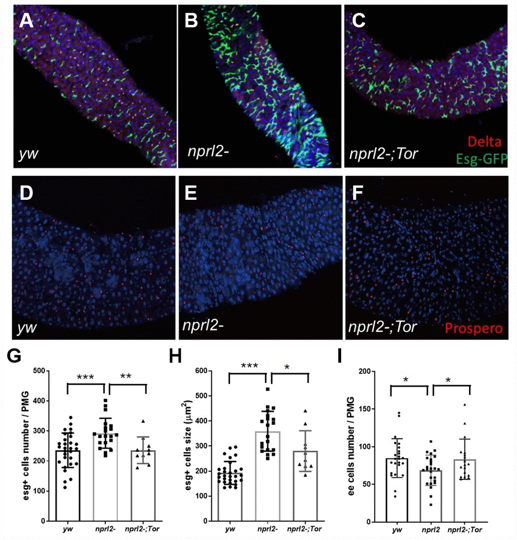 nprl2 mutation affected ISCs and EE cells in the midgut. (A–C) Newly hatched (A) yw; esg-Gal4, UAS-GFP, tub-Gal80ts, (B) nprl21; esg-Gal4, UAS-GFP, tub-Gal80ts and (C) nprl21; esg-Gal4, UAS-GFP, tub-Gal80ts / TorA594V flies were cultured on standard food for 15 days at 18°C, then transferred to 29°C and cultured for a further 3 days. Flies were dissected and stained with anti-Delta antibody. (D–F) Fifteen-day-old (D) yw, (E) nprl21 and (F) nprl21; TorA594V/+ flies were dissected and stained with an anti-Prospero antibody. (G) The number of Esg+ cells in the posterior midgut (PMG) was counted. (H) The size of Esg+ cells in the PMG was measured. (I) The number of Prospero+ cells in the PMG was counted. Error bars represent the SD of the indicated number of data points. *P P P 