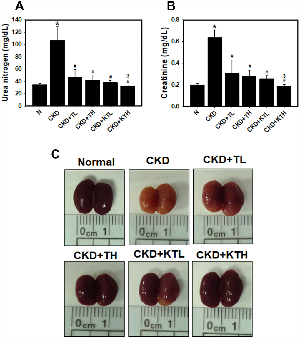 Serum biochemistry parameters and direct observations of the kidneys in an adenine-induced CKD model following TG NP and KIM-1-TG NP treatment. (A) (B) Analysis of serum biochemistry parameters. Creatinine and urea nitrogen levels were assessed after TG NP or KIM-1-TG NP injection. *p C) Images of an entire kidney. After the experiments, the mice were sacrificed, and the kidneys were removed. N indicates normal group. CKD indicates that mice are adenine-fed and intraperitoneally injected saline. TL indicates low-concentration (0.1 mg/kg) TG NP group. TH indicates high-concentration (0.2 mg/kg) TG NP. KTL indicates low-concentration (0.1 mg/kg) KIM-1-TG NP group. KTH indicates high-concentration (0.2 mg/kg) KIM-1-TG NP group. Details of the mouse model are described in “Materials and Methods”.