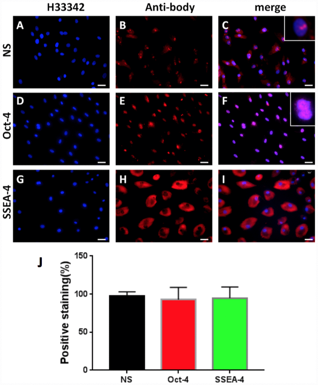 Stem cell marker expression of rabbit AF cells tested by immunostaining. (A–C) nucleostemin testing; (D–F) Oct-4 testing; (G–I) SSEA-4 testing. (A, D, G) the cells were stained with H33342; (B, E, L) the cells were stained with specific antibodies; (C, F, I) the merged images of the images of A, D, G and the images of B, E, L. The insets showed enlarged views of expressed nucleostemin (C) and Oct-4 (F). (J) Semi-quantification of the expression of three stem markers by immunostaining. The results indicated that more than 92% of the cells isolated from rabbit AF tissues were stem cells. Bars = 100 μm.