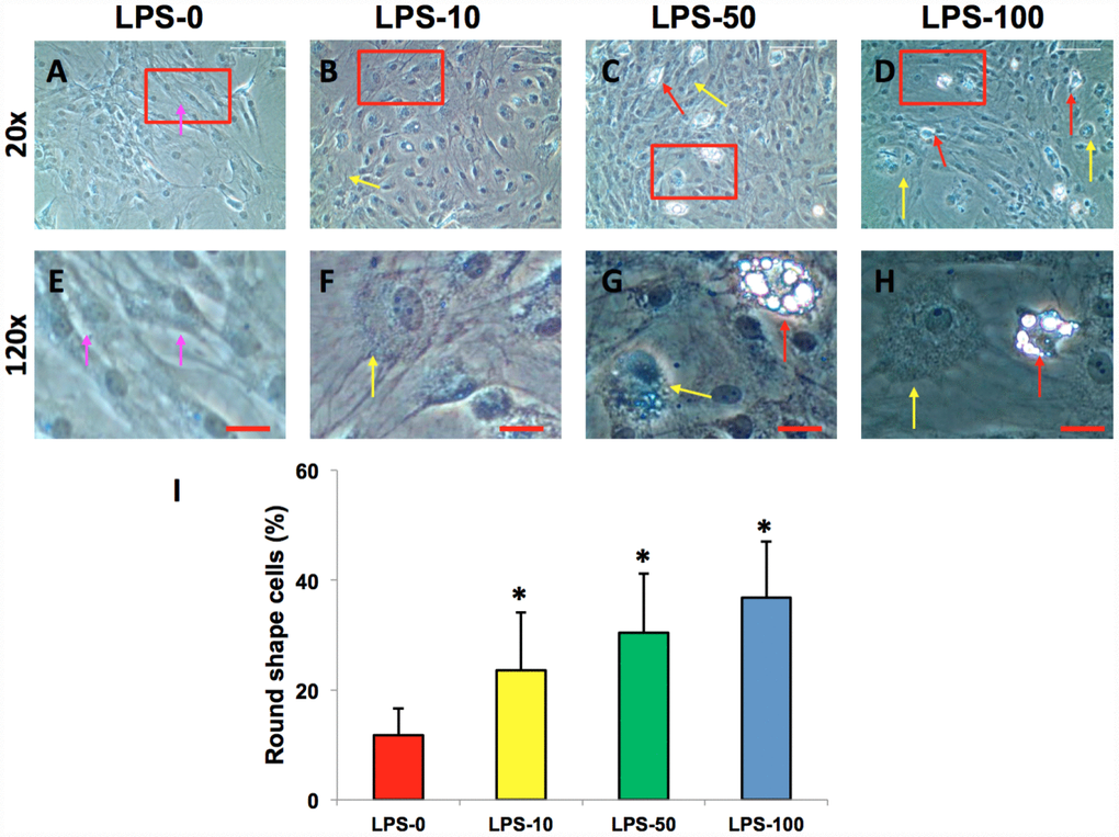 LPS effect on the proliferation and differentiation of rabbit AF cells cultured for 7 days. LPS not only decreased the proliferation of rabbit AF cells, but also induced significantly morphological change in rabbit AF cells during the culture (A–H). The results showed that the cell number was decreased with increasing the concentration of LPS. Many cells have changed their shape from spindle shape to round shape (yellow arrows in B–D, F–H). Some adipocyte-like cells were also found in the LPS-treated groups (red arrows in C, D, G, H). Semi-quantification indicated that the round shape cells were increased at a LPS concentration dependent manner (I). The images of E–H were the enlarged images of the box areas in the images of A–D. *p