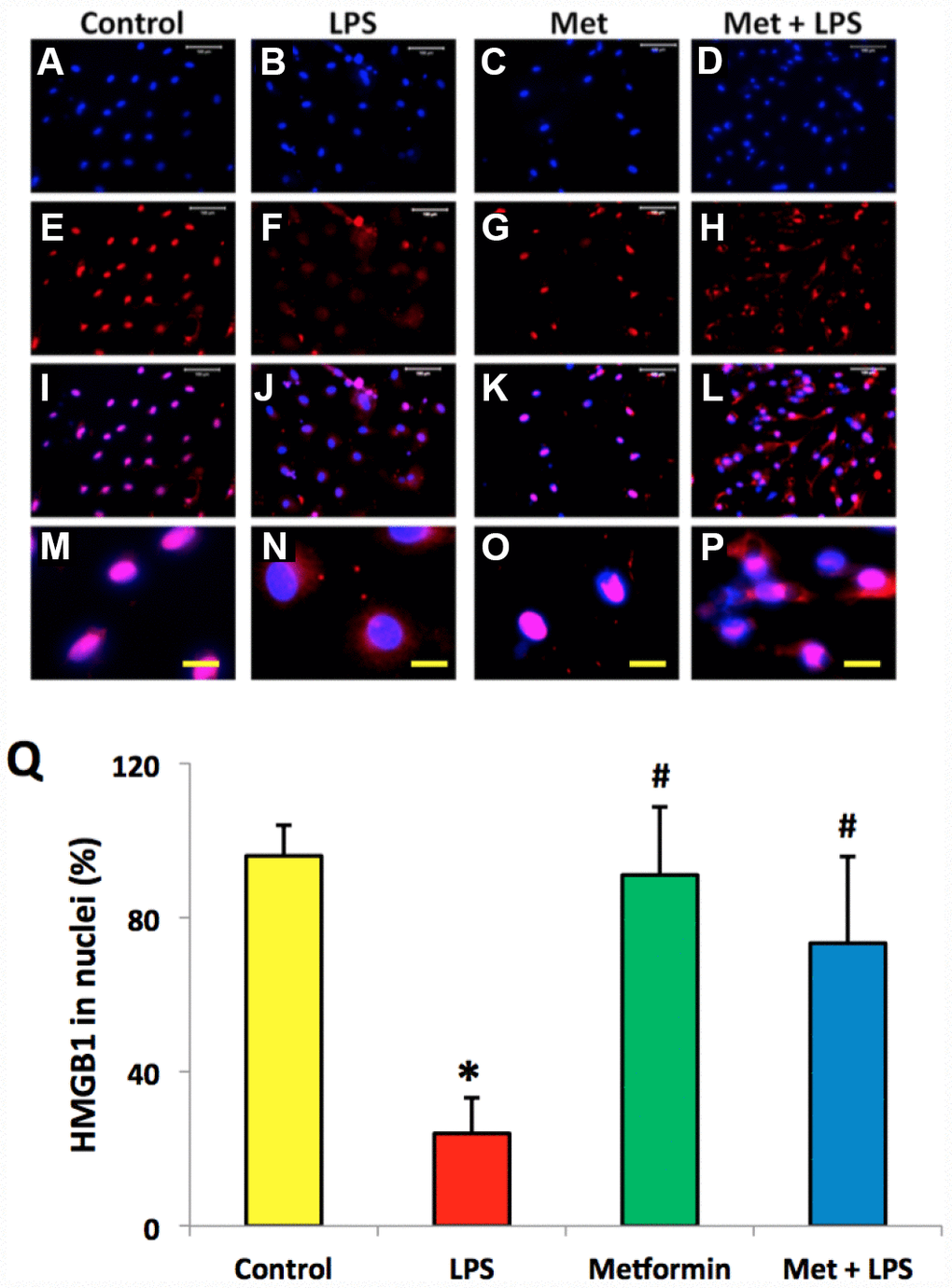 Metformin inhibited the relocation of HMGB1 in rabbit AF cells induced by LPS. (A–D) H33342 staining. (E–H) anti-HMGB1 antibody staining. (I–L) merged images of the H33342 stained images (A–D) and anti-HMGB1 antibody stained images (E–H). (M–P) the enlarged images of the box areas of the images of (E–H, Q) semi-quantification of positive stained HMGB1 in the nuclei of the cells. More than 95% of the nuclei of the normal cells were positively stained with HMGB1 (I, M, Q). LPS induced HMGB 1 releasing from the nucleus of rabbit AF cells to the cytoplasma (J, N, Q). Metformin blocked the relocation of HMGB1 as evidenced by the concentration of HMGB1 in the nuclei (K, O, Q). *p#p