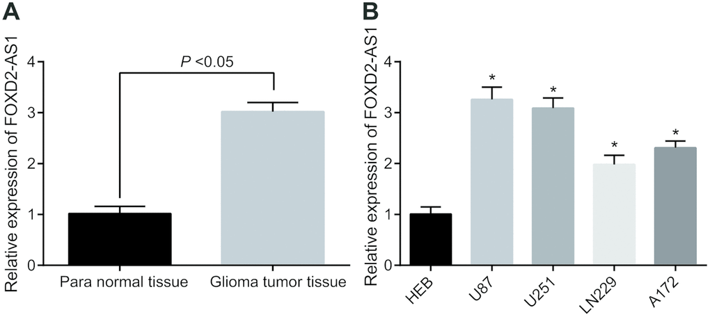 Highly expressed FOXD2-AS1 is found in glioma. (A) The expression level of FOXD2-AS1 in glioma tumor tissues and corresponding para normal tissues was detected by RT-qPCR (N = 68); (B) RT-qPCR was used to detect the expression of FOXD2-AS1 in human normal glial brain cell line HEB and 4 human glioma cell lines. * P 