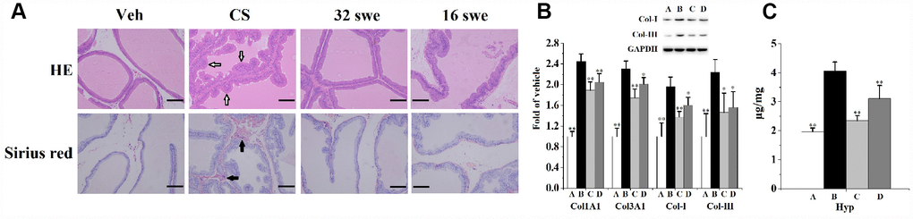 (A) HE and sirius red staining (n=6 per group, magnification ×200, scale bar=100 μm) for the evaluation of prostate morphological changes and collagen deposition. Hollow arrow: irregular bulges. Solid arrow: collagen deposition. (B) Prostatic mRNA levels (n=4 per group) of Col1A1 and Col3A1, as well as the expression (n=3 per group) of Col-I and Col-III. (C) Prostatic content of Hyp (n=6 per group). **p*p