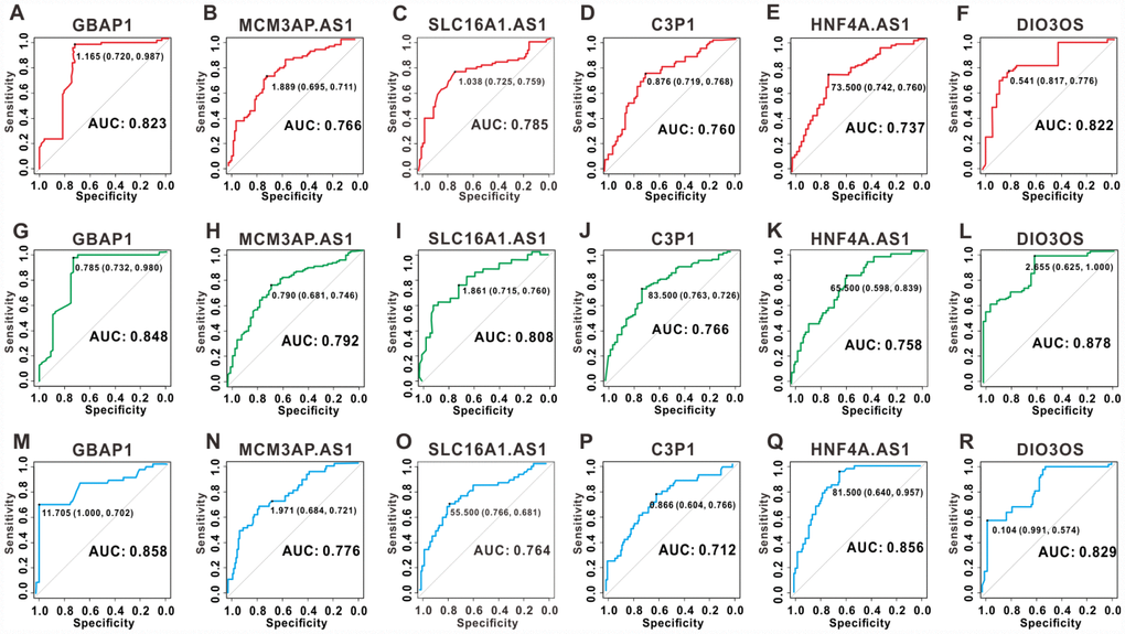 ROC curves for the six key lncRNAs in 158 clinical samples. ROC curves of lncRNA GBAP1, MCM3AP-AS1, SLC16A1-AS1, C3P1, HNF4A-AS1 and DIO3OS for OS (A–F), PFS (G–L), and DmFS (M–R) respectively. The AUCs under binomial exact confidence interval was calculated to generate the ROC curve.