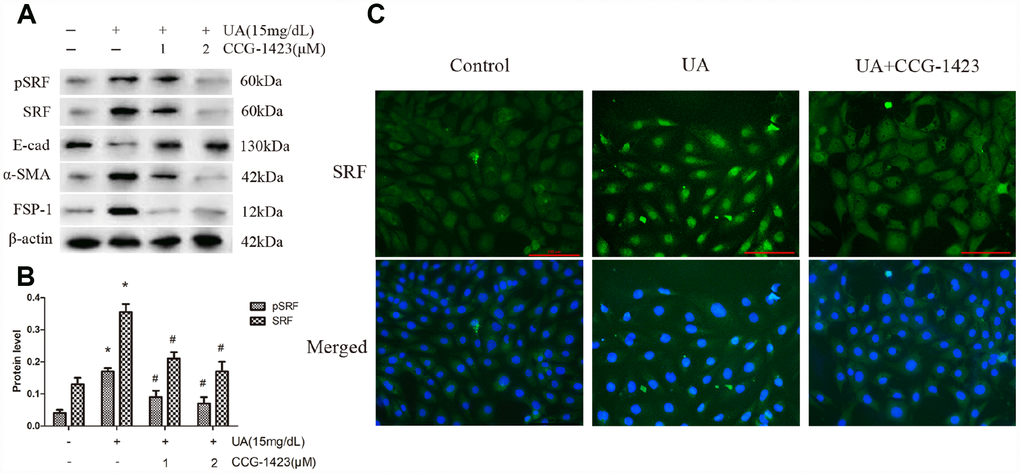 Inhibition of SRF preserved the phenotype of NRK-52E cells after UA stimulation in vitro. NRK-52E cells were pretreated with CCG-1423 (1 μM or 2 μM) or DMSO for 1 h, followed by treatment with UA (15 mg/dL) for 72 h. (A) Protein expression of pSRF, SRF, E-cadherin, α-SMA and FSP-1 measured by western blot analysis. (B) Quantitative determination of the pSRF and SRF protein levels. (C) Immunofluorescence staining for SRF at an original magnification of 400×. CCG-1423 was used at a concentration of 2 μM. *P#P