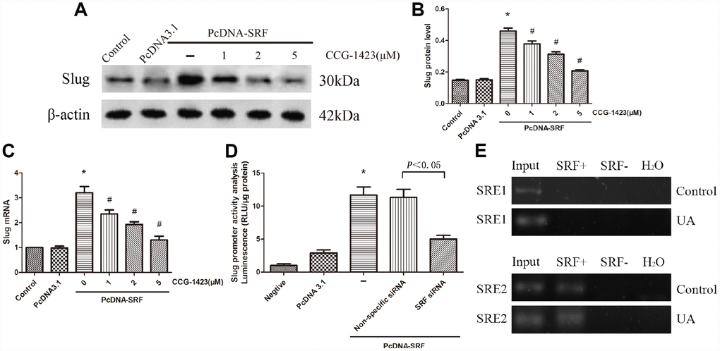 Inhibition of SRF suppressed slug expression upregulation in vitro. (A–C) NRK-52E cells were transfected with pcDNA3.1-SRF or empty pcDNA3.1 vectors. After 24 h, the cells were incubated with different doses of CCG-1423 for another 24 h. The protein and mRNA expression levels of slug were measured by western blot analysis and quantitative RT-PCR. (D) Slug promoter activity was analyzed by measuring luminescence. (E) Chromatin immunoprecipitation was used to examine SRF binding to the slug promoter in NRK-52E cells. Reaction controls included immunoprecipitations performed using a nonspecific IgG monoclonal antibody; PCR was performed using whole cell genomic DNA (Input). N=6 in each group. *P