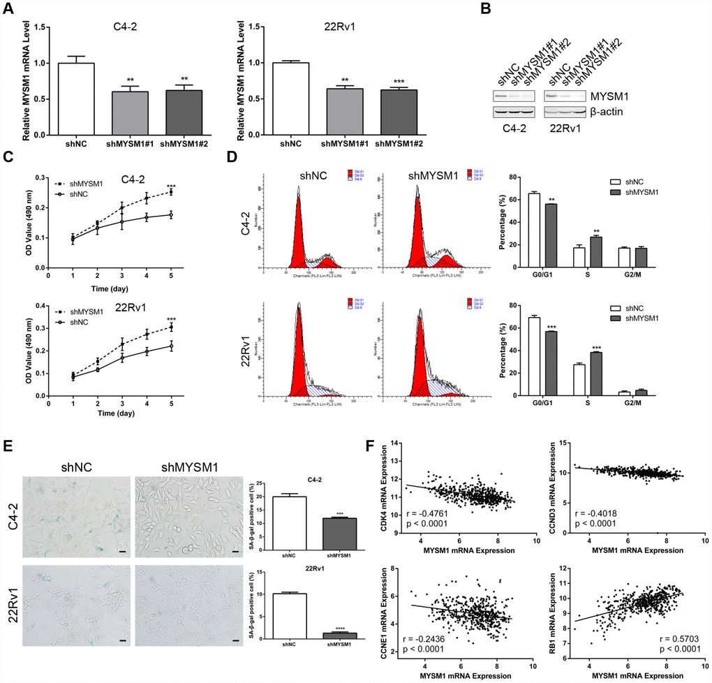 MYSM1 knockdown promotes proliferation and suppresses senescence of prostate cancer cells. (A–B) MYSM1 expression levels in CRPC cell lines (C4-2, 22Rv1) stably expressing shRNA targeting MYSM1 (shMYSM1) or negative control (shNC) were detected by qRT-PCR (A) and Western blot (B) analyses. Data are shown as mean ± SEM of 3 replicates. ** P C) Proliferation of shNC/shMYSM1-treated C4-2/22Rv1 cells was evaluated by MTT assay. Data are shown as mean ± SEM of 3 replicates. (D) Flow cytometry analysis of cell cycle in C4-2/22Rv1 cells treated with shNC/shMYSM1. Data are shown as mean ± SD of 3 replicates. ** P E) Representative images of SA-β-gal staining in C4-2/22Rv1 cells treated with shNC/shMYSM1. Scale bars are 25 μm. Data are shown as mean ± SD of 3 replicates. *** P F) Correlation of MYSM1 with CDK4, CCND3, CCNE1 and RB1 mRNA levels in prostate cancers. Data were collected from TCGA database and analyzed via LinkedOmics bioinformatics. Pearson correlation coefficients and significance levels are indicated.